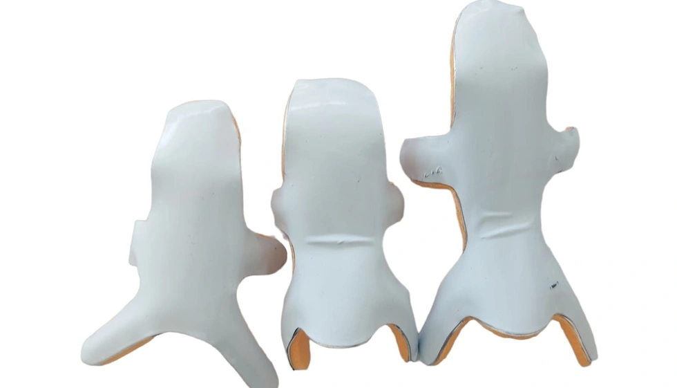 Frog Finger Splint