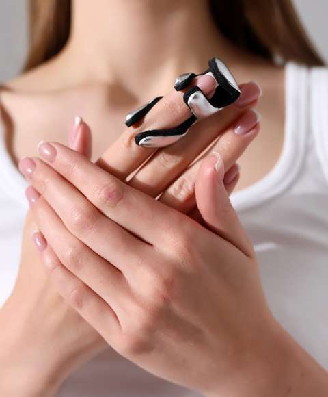 Frog Splint – Orthopedic Finger Splint and Clinical Use